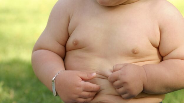 Obesity